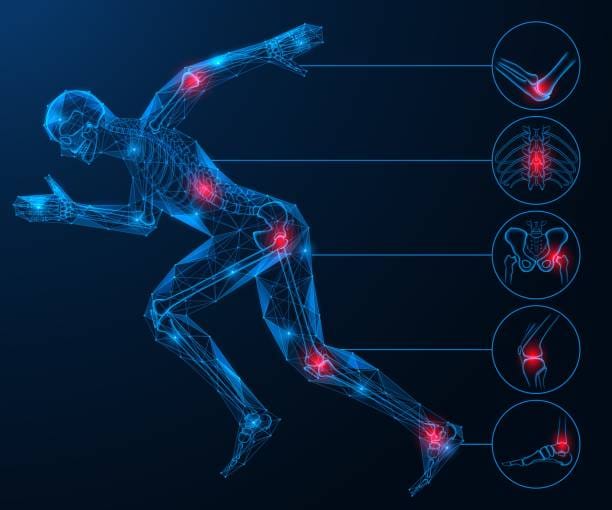 Running person, joint pain when moving. Running person, joint pain when moving. Polygonal design of interconnected lines and dots. Blue background. 3D Motion Analysis stock illustrations